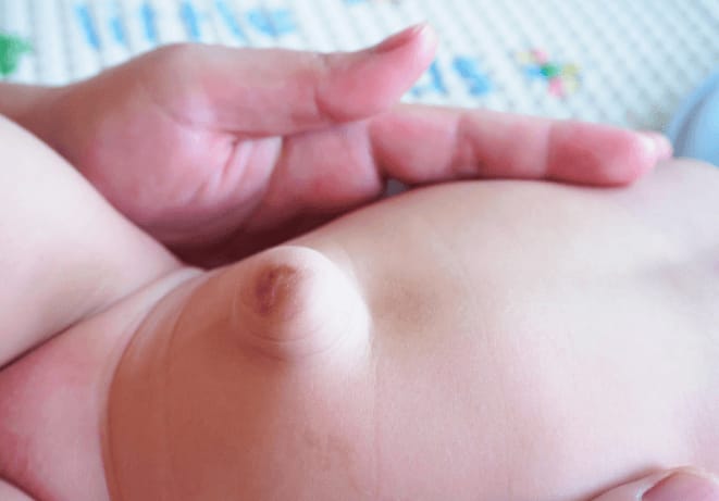 DZIECIĘCY PAS PRZEPUKLINOWY BRZUSZNY AM-PPB 1 REH4MAT